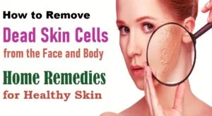 Dead Skin Cells