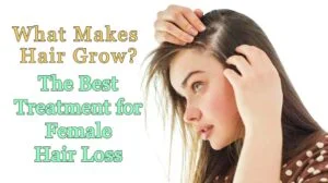 Female Hair Loss Treatment