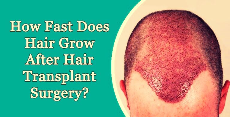 After Hair Transplant Surgery